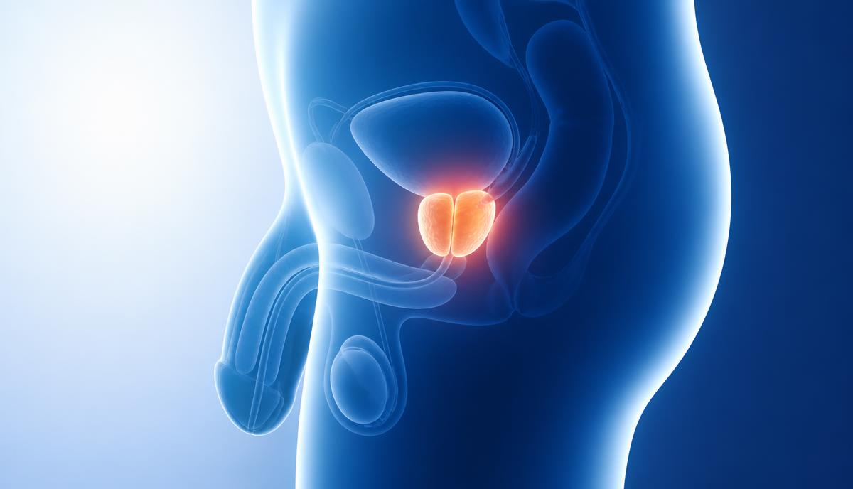 Illustrazione medica dell'anatomia maschile con prostata ingrossata evidenziata